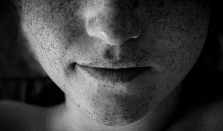 Artistic black and white close-up of a face highlighting freckles and lips. — Find New Ways to Earn Money Today